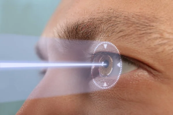 Laser Eye Surgery for Astigmatism